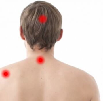 Osteochondrozės židiniai