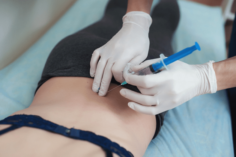 juosmens osteochondrozės blokada